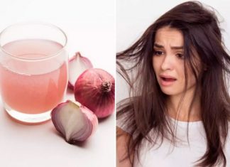 Crni luk za kosu: 12 načina za upotrebu (RECEPTI) crni luk za rast kose