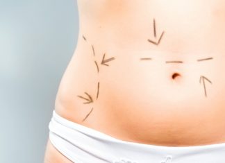 Liposkukcijska ishrana – dijeta za mršavljenje koja je osvojila Balkan liposukcijska dijeta